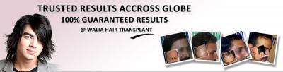 Hair Transplant Punjab at Cheapest Cost Hair Transplant Punjab at Cheapest Cost